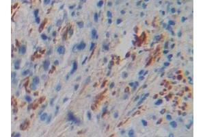Immunohistochemistry (IHC) image for anti-Filamin C, gamma (FLNC) (AA 17-259) antibody (ABIN7441958)