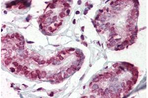 Human Breast (formalin-fixed, paraffin-embedded) stained with CD44 antibody ABIN364348 at 5 ug/ml followed by biotinylated anti-mouse IgG secondary antibody ABIN481714, alkaline phosphatase-streptavidin and chromogen. (CD44 antibody  (AA 21-145))