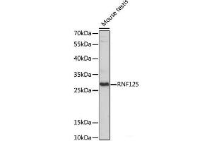 Western blot analysis of extracts of Mouse testis using RNF125 Polyclonal Antibody at dilution of 1:1000. (RNF125 antibody)