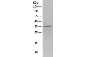 UTP20, Small Subunit (SSU) Processome Component (UTP20) (AA 946-1053) protein (His-IF2DI Tag)