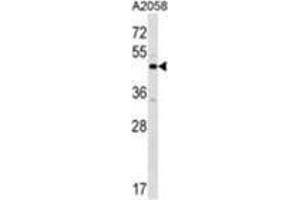XKR3 Antibody (C-term) western blot analysis in A2058 cell line lysates (35 µg/lane). (XKR3 antibody  (C-Term))