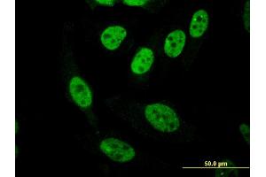 Immunofluorescence of monoclonal antibody to PASD1 on HeLa cell. (PASD1 antibody  (AA 1-100))