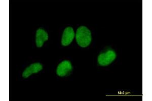 Immunofluorescence of purified MaxPab antibody to METTL3 on HeLa cell.
