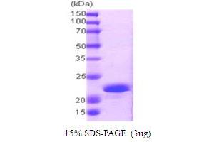 SDS-PAGE (SDS) image for Protein Phosphatase 1, Regulatory (Inhibitor) Subunit 14A (PPP1R14A) (AA 1-147) protein (His tag) (ABIN667711) (CPI-17 Protein (AA 1-147) (His tag))