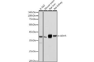 Western blot analysis of extracts of various cell lines, using /GSNOR antibody (ABIN6131172, ABIN6136579, ABIN6136580 and ABIN6217464) at 1:500 dilution. (ADH5 antibody  (AA 1-374))