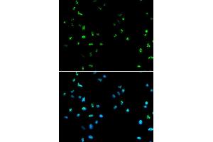 Immunofluorescence analysis of A549 cell using HDAC4 antibody. (HDAC4 antibody  (AA 530-630))