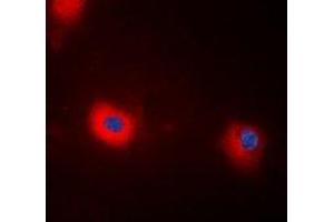 Immunofluorescent analysis of MYPT1 (pT696) staining in HEK293T cells. (PPP1R12A antibody  (pSer696))