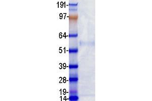 Western Blotting (WB) image for Proprotein Convertase Subtilisin/kexin Type 9 (PCSK9) protein (DYKDDDDK-His Tag) (ABIN2728449)