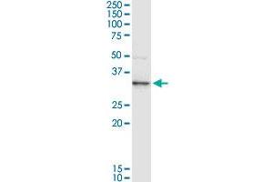 ANXA3 MaxPab rabbit polyclonal antibody. (Annexin A3 antibody  (AA 1-323))