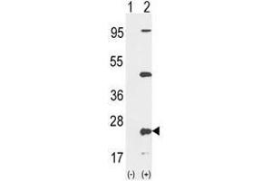 Western blot analysis of PTP4A2 (arrow) using rabbit polyclonal PTP4A2 Antibody (Center) . (PTP4A2 antibody  (Middle Region))