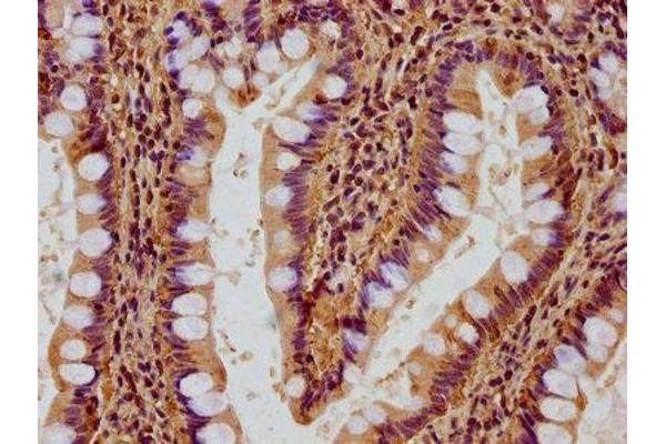 GNB2L1 antibody  (AA 93-317)