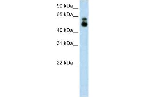 WB Suggested Anti-HDAC9 Antibody Titration:  1.