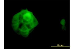 Immunofluorescence (IF) image for anti-Ubiquilin 2 (UBQLN2) (AA 555-624) antibody (ABIN565449)