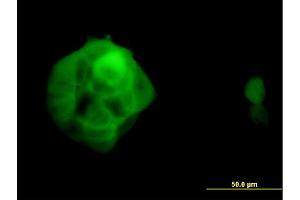 Immunofluorescence of monoclonal antibody to UBQLN2 on A-431 cell. (Ubiquilin 2 antibody  (AA 555-624))