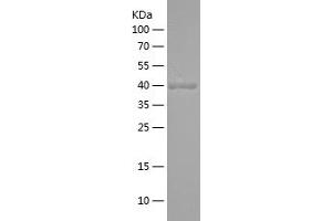 Western Blotting (WB) image for Glucagon (GCG) (AA 21-180) protein (His-IF2DI Tag) (ABIN7282514) (Glucagon Protein (GCG) (AA 21-180) (His-IF2DI Tag))