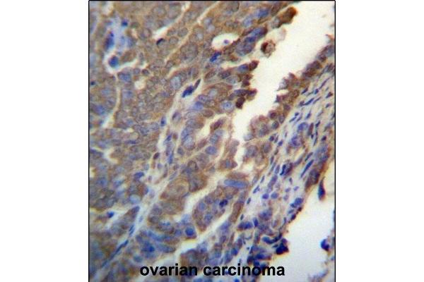 ASB4 antibody  (C-Term)