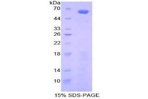 SDS-PAGE analysis of Mouse Insulin Like Growth Factor Binding Protein 2 (IGFBP2) Protein. (IGFBP2 Protein)