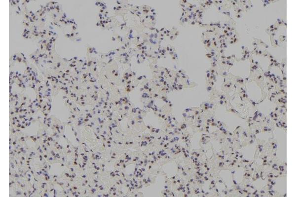 TTF1 antibody  (Internal Region)