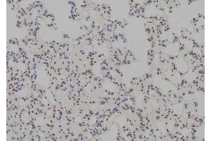 ABIN6278744 at 1/100 staining Rat lung tissue by IHC-P. (TTF1 antibody  (Internal Region))
