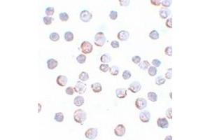 Immunocytochemical staining of HeLa cells with MAEL polyclonal antibody  at 5 ug/mL dilution. (MAEL antibody  (C-Term))
