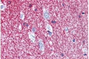 Human Brain, cortex: Formalin-Fixed, Paraffin-Embedded (FFPE) (Cnpase antibody  (AA 122-352))