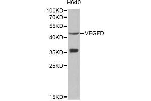 Western blot analysis of extracts of H640 cells, using VEGFD antibody (ABIN1872695) at 1:1000 dilution.