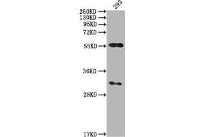 Western Blot Positive WB detected in: 293 whole cell lysate All lanes: CAMK2A antibody at 1:2000 Secondary Goat polyclonal to rabbit IgG at 1/50000 dilution Predicted band size: 55, 56 kDa Observed band size: 55 kDa (CAMK2A antibody  (AA 321-478))