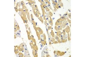 Immunohistochemistry of paraffin-embedded mouse heart using HNMT antibody (ABIN6292124) at dilution of 1:100 (40x lens).