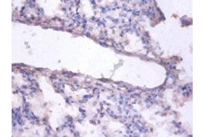Immunohistochemistry of paraffin-embedded human lung tissue using ABIN7151790 at dilution of 1:100 (ERH antibody  (AA 2-104))