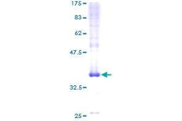 C20orf30 Protein (AA 1-120) (GST tag)