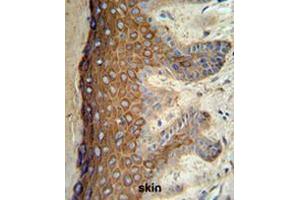 KRT1 Antibody (Center) IHC analysis in formalin fixed and paraffin embedded skin tissue followed by peroxidase conjugation of the secondary antibody and DAB staining. (Cytokeratin 1 antibody  (Middle Region))