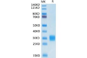 Biotinylated Human ULBP-1 on Tris-Bis PAGE under reduced condition. (ULBP1 Protein (His-Avi Tag,Biotin))
