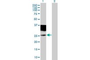 Western Blot analysis of IL4R expression in transfected 293T cell line by IL4R MaxPab polyclonal antibody. (IL4 Receptor antibody  (AA 1-227))