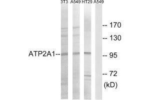 Western blot analysis of extracts from NIH/3T3 cells, A549 cells and HT-29 cells, using ATP2A1 antibody. (ATP2A1/SERCA1 antibody  (Internal Region))