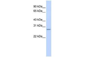 WB Suggested Anti-VASH1 Antibody Titration: 0.