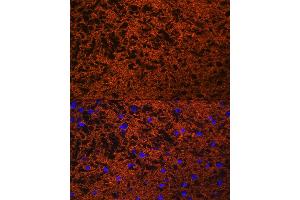 Immunofluorescence analysis of rat brain using SN Rabbit pAb (ABIN3021231, ABIN3021232, ABIN3021233 and ABIN6214078) at dilution of 1:100 (40x lens).