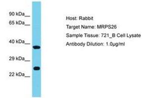 Image no. 1 for anti-Mitochondrial Ribosomal Protein S26 (MRPS26) (AA 134-183) antibody (ABIN6750657) (MRPS26 antibody  (AA 134-183))