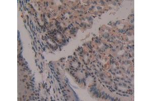 Used in DAB staining on fromalin fixed paraffin- embedded Kidney tissue (HAND1 antibody  (AA 1-216))