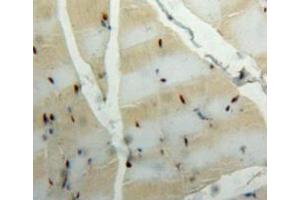 Used in DAB staining on fromalin fixed paraffin-embedded muscle tissue (CA3 antibody  (AA 27-217))