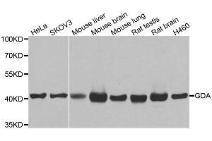 Western blot analysis of extracts of various cell lines, using GDA antibody. (GDA antibody)