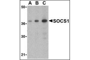 Western blot analysis of SOCS1 in Human spleen cell lysate with this product at (A) 1, (B) 2 and (C) 4 μg/ml. (SOCS1 antibody  (C-Term))