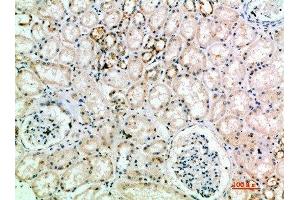 Immunohistochemical analysis of paraffin-embedded human-kidney, antibody was diluted at 1:200 (L1CAM antibody  (AA 151-200))