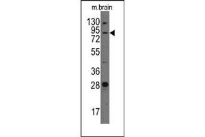 Image no. 1 for anti-Junctophilin 3 (JPH3) (Middle Region) antibody (ABIN357848) (Junctophilin 3 antibody  (Middle Region))