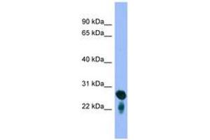 Image no. 1 for anti-RAB5C, Member RAS Oncogene Family (Rab5c) (C-Term) antibody (ABIN6745664)