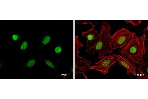 ICC/IF Image Cyclin A2 antibody detects Cyclin A2 protein at nucleus by immunofluorescent analysis.