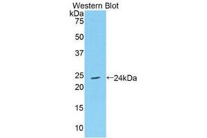 Western Blotting (WB) image for anti-TIMP Metallopeptidase Inhibitor 4 (TIMP4) (AA 40-224) antibody (ABIN1172388)