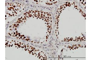 Immunoperoxidase of monoclonal antibody to DHX9 on formalin-fixed paraffin-embedded human testis.