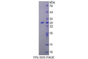 SDS-PAGE (SDS) image for Ninein (GSK3B Interacting Protein) (NIN) (AA 1-153) protein (His tag) (ABIN4989448)