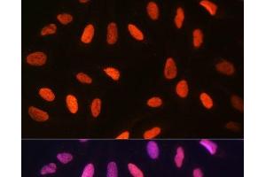 Immunofluorescence analysis of U-2 OS cells using DiMethyl-Histone H3-K14 Polyclonal Antibody at dilution of 1:100 (40x lens). (Histone 3 antibody  (2meLys14))