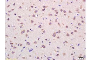 Formalin-fixed and paraffin embedded rat brain labeled with Rabbit Anti VDAC Polyclonal Antibody, Unconjugated (ABIN686872) at 1:200 followed by conjugation to the secondary antibody and DAB staining